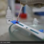 Nueva y más transmisible variante de VIH