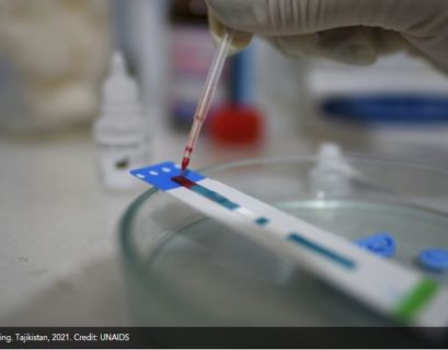 Nueva y más transmisible variante de VIH