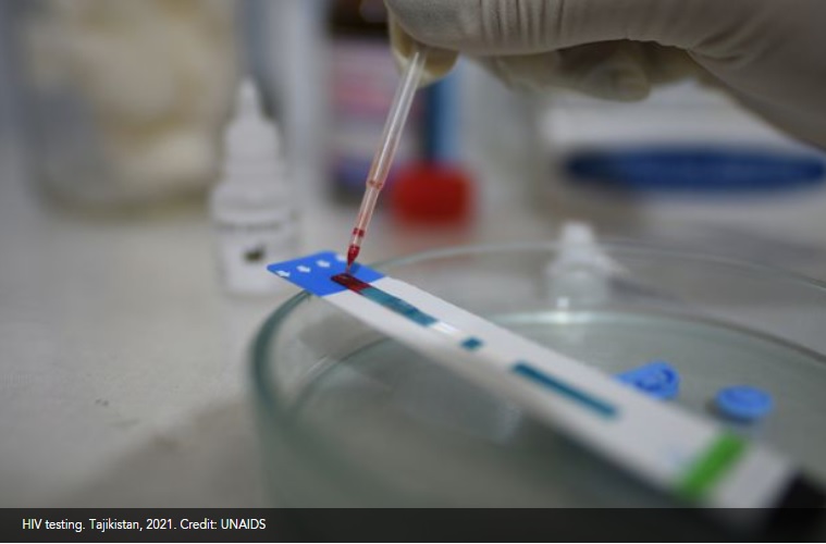 Nueva y más transmisible variante de VIH